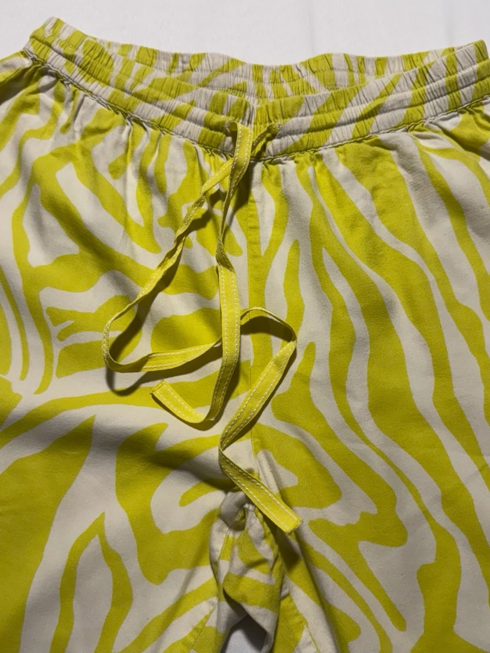 Anthropologie 2-piece Pajama Set Yellow White Zebra Print Button Top & Pants SzM - Picture 11 of 13